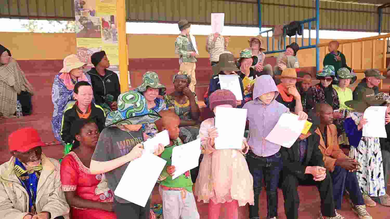 Rutsiro: Abafite ubumuga bw’uruhu bahawe ibikoresho bibafasha kwirinda izuba no kwita ku ruhu